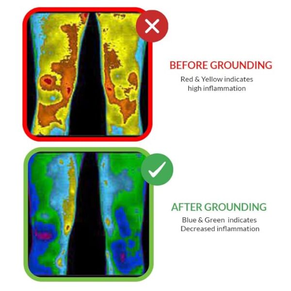 Universal Grounding Mat Kit (Starter Pack) - Image 5